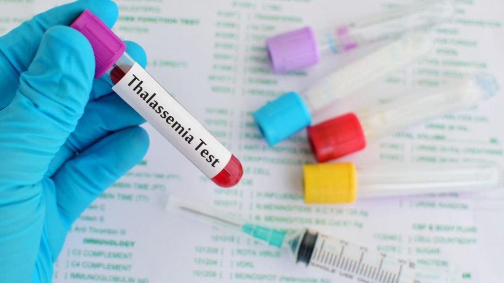 Thalassemia: Types, Diagnosis and Treatment
