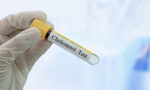 Cholesterol-test-diagnosis