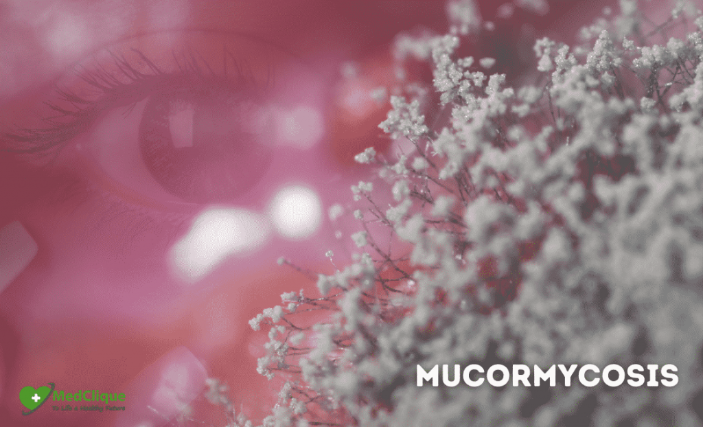 Everything about mucormycosis